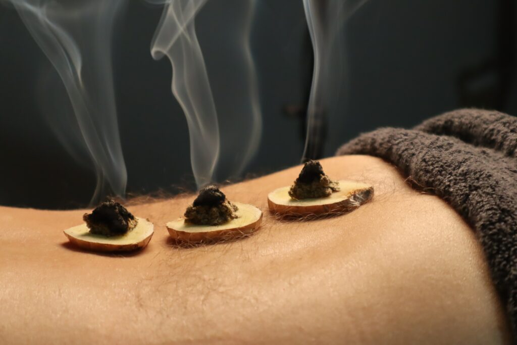 cônes de moxibustion sur gingembre