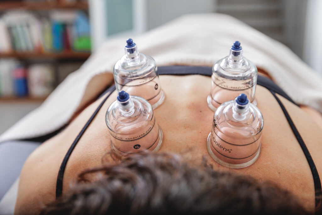 ventouses cupping